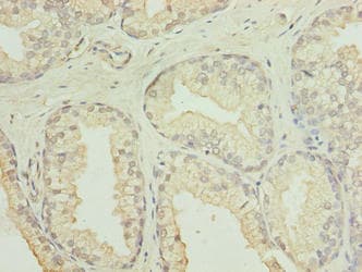 Polyclonal Rabbit anti-Human C20orf11 / TWA1 Antibody (IHC)
