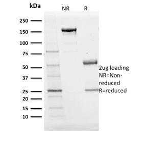 POU2AF1 / BOB1 Antibody (clone BOB1/2424)