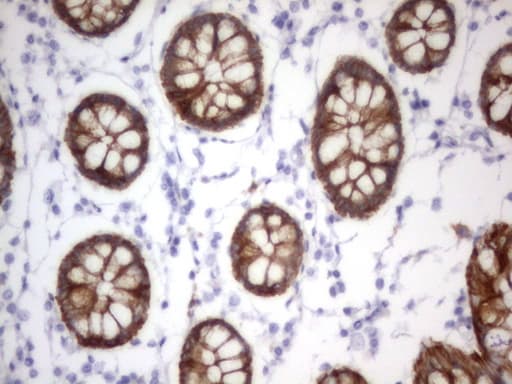 Acidic Cytokeratin Antibody (clone 3E10)