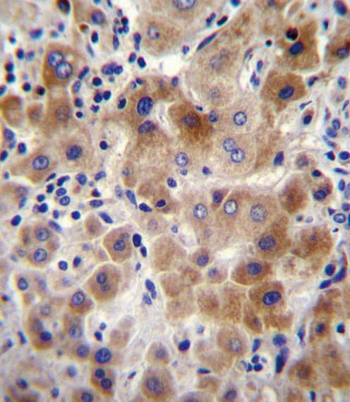 NEU2 / Sialidase 2 Antibody (aa23-50)