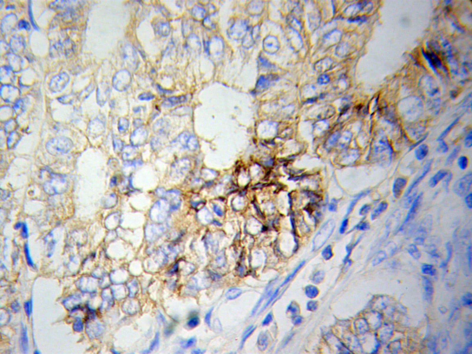 NAMPT / Visfatin Antibody