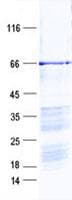 Human ZNF276 Protein (Recombinant His, N-Terminal)
