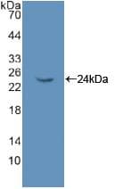 NME6 Antibody (aa13-241, Biotin)