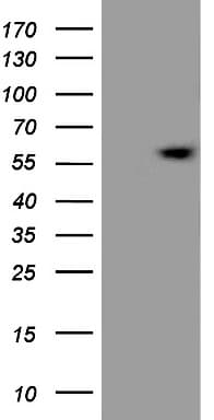 ESRRB / ERR Beta Antibody (aa1-252, clone OTI7C7)