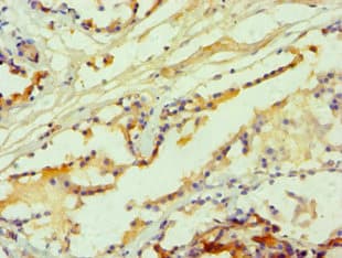 Polyclonal Rabbit anti-Human HTR2B / 5-HT2B Receptor Antibody (IHC)