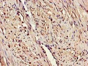ARTS1 / ERAP1 Antibody