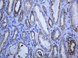 KRT5 / CK5 / Cytokeratin 5 Antibody (clone OTI4A7)
