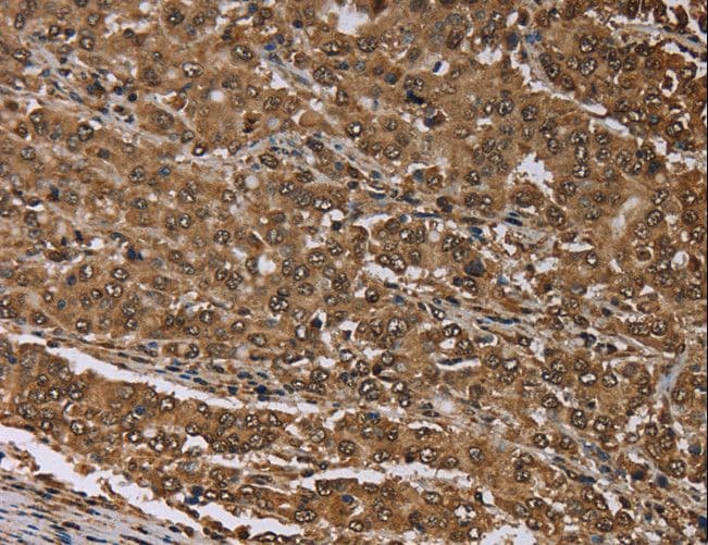 Polyclonal Rabbit anti-Human MEIS1 Antibody (IHC)