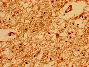 TRNP1 Antibody