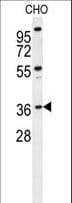 Polyclonal Rabbit anti-Human EXO5 / Exonuclease 5 Antibody (aa166-193, WB)