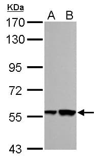 Polyclonal Rabbit anti-Human RBMY1A1 Antibody (aa253-496, IHC, WB)