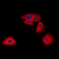 Polyclonal Rabbit anti-Human CLDN6 / Claudin 6 Antibody (aa103-137, IHC, IF, WB)