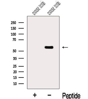 Polyclonal Rabbit anti-Human MGAT4C Antibody (WB)