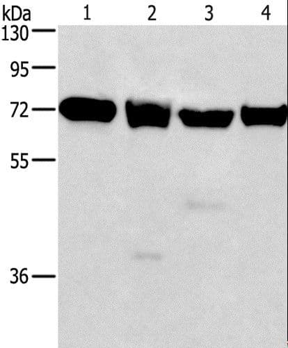 IL2RB / CD122 Antibody