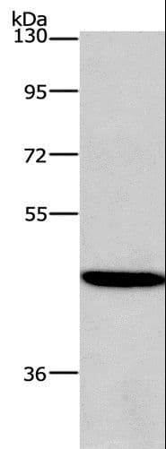 HDAC8 Antibody