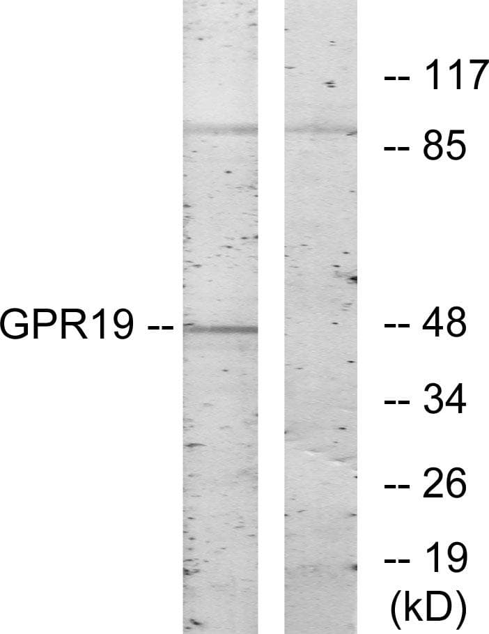 GPR19 Antibody