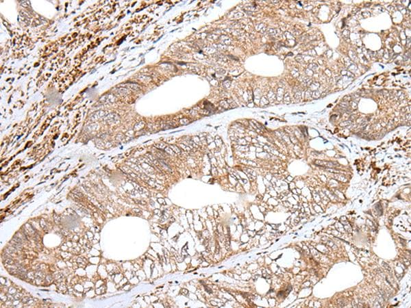 ENPEP / Aminopeptidase A Antibody