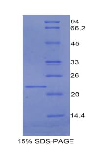 Rat PROCR / EPCR Protein (Recombinant His)