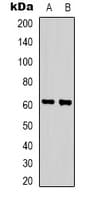 ZNF397 Antibody (N-Terminus)