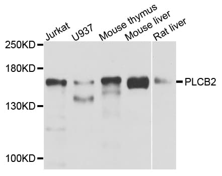 PLCB2 Antibody