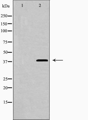 LGALS9 / Galectin 9 Antibody
