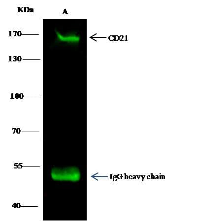 Polyclonal Rabbit anti-Human CR2 / CD21 Antibody (Preservative Free, IHC, WB)