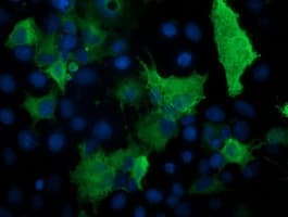 PRKAR1B Antibody (clone OTI12E5)