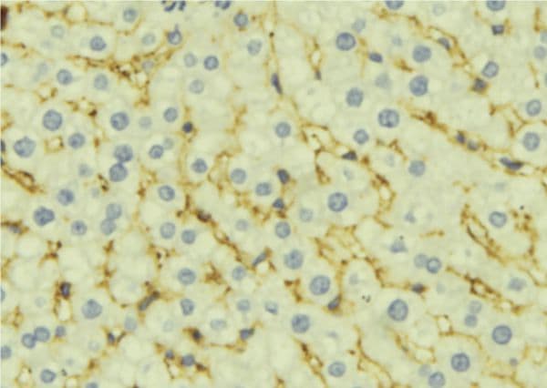 Polyclonal Rabbit anti-Human P5CDH / ALDH4A1 Antibody (IHC, WB)