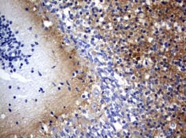 Monoclonal Mouse anti-Human VILIP / VSNL1 Antibody (clone OTI4C2, IHC, WB)