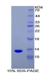 Rat SLIT3 Protein (Recombinant His-S)