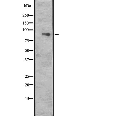 CUL5 / Cullin-5 Antibody