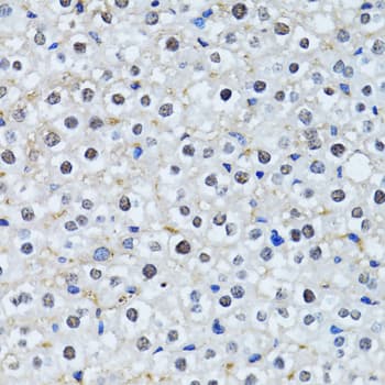 Polyclonal Rabbit anti-Human HIST2H2BE Antibody (IHC, WB)
