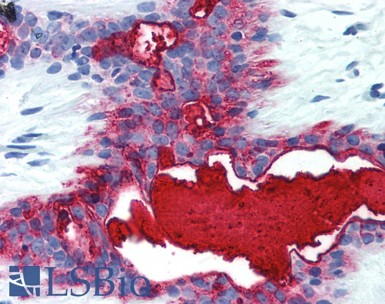 IHC-plus™ EMA / MUC1 Antibody