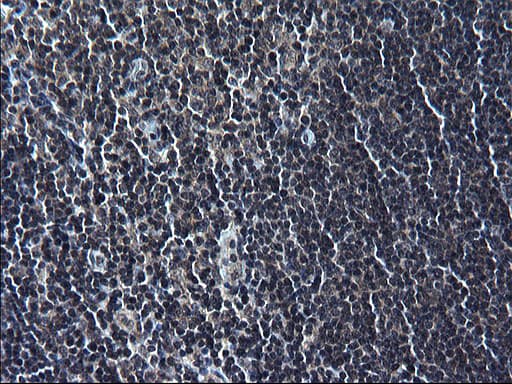 ZFAND3 / TEX27 Antibody (clone OTI1G7)