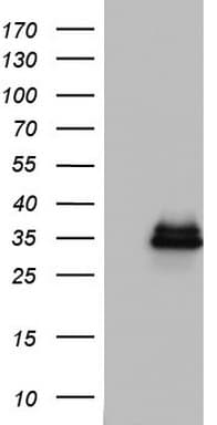 HADH Antibody (aa57-314, clone OTI3F11)