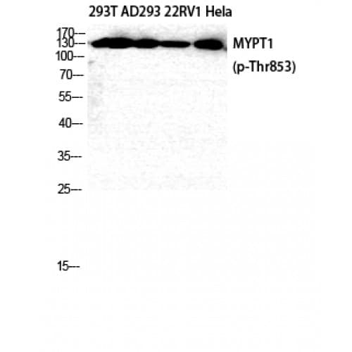Polyclonal Rabbit anti-Human PPP1R12A / MYPT1 Antibody (590-670 aa, IHC, WB)