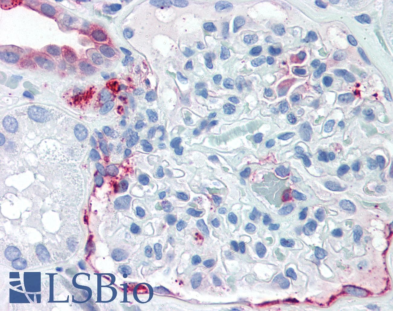 IHC-plus™ SLC39A14 / ZIP14 Antibody (Internal)