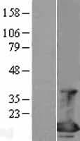 Human EIF4EBP1 / 4EBP1 Protein (Over-Expression Lysate Myc-DDK (Flag))