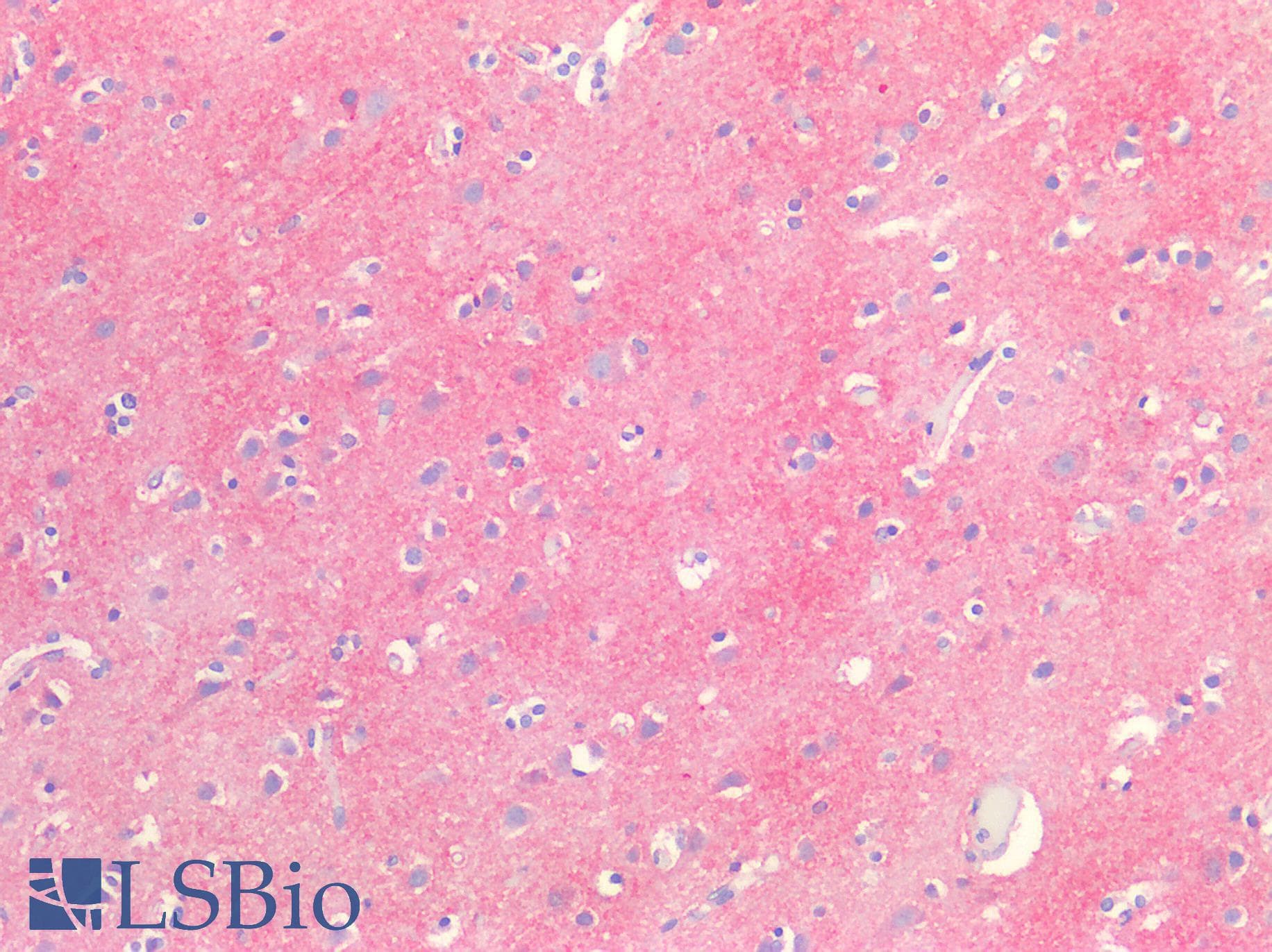 PathPlus™ Polyclonal Rabbit anti-Human IGSF4C / CADM4 Antibody (C-Terminus, IHC, WB)