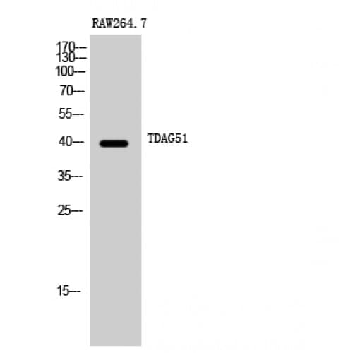 PHLDA1 Antibody (240-320 aa, C-terminal)
