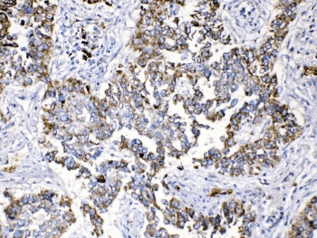 PPL / Periplakin Antibody