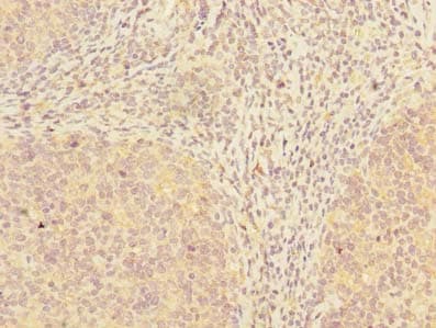 ADAT1 Antibody