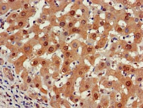 Polyclonal Rabbit anti-Human PSMA5 Antibody (IHC, WB)