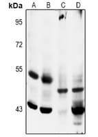 MAP2K5 / MEK5 Antibody