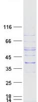 Human SLC25A16 / GDA / Graves Protein (Recombinant Myc-DDK (Flag))