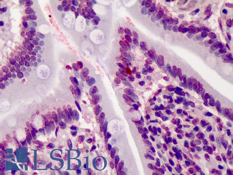 BAP1 Antibody (clone 1G8, DY550)