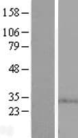 SPSB1 Protein (Over-Expression Lysate Myc-DDK (Flag))