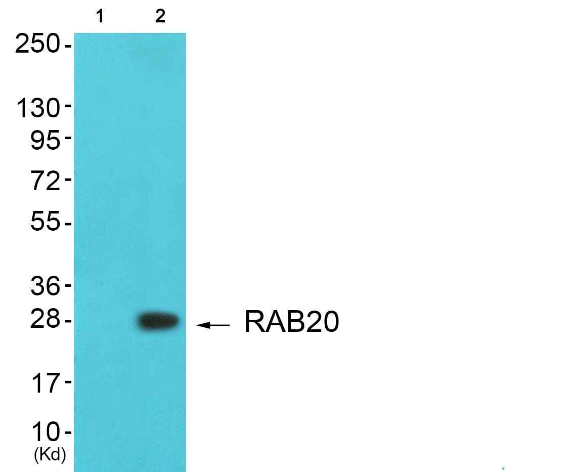 RAB20 Antibody