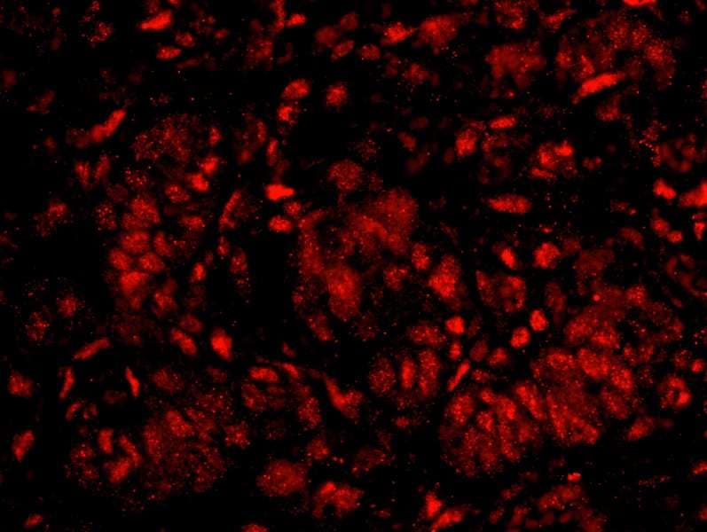 IHC-plus™ QIP1 / KPNA4 Antibody (aa471-521)