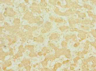 TEKT3 Antibody